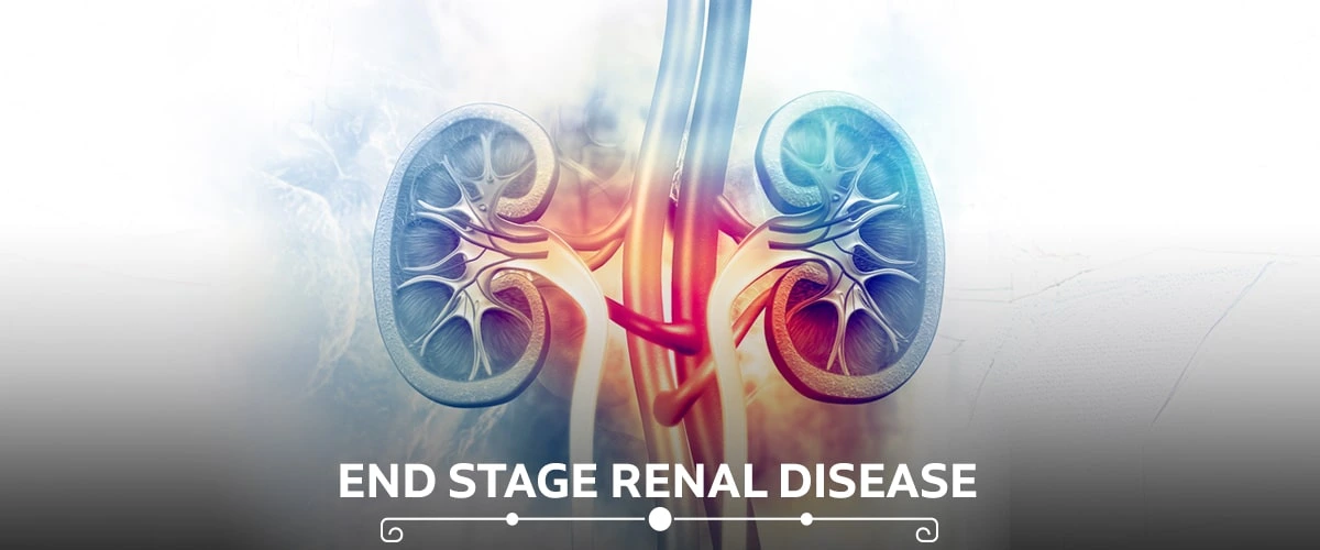 End Stage kidney Disease treatment near me